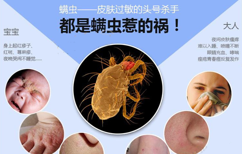 免费除螨报名正式启动!!插图5 免费除螨报名正式启动!!插图5